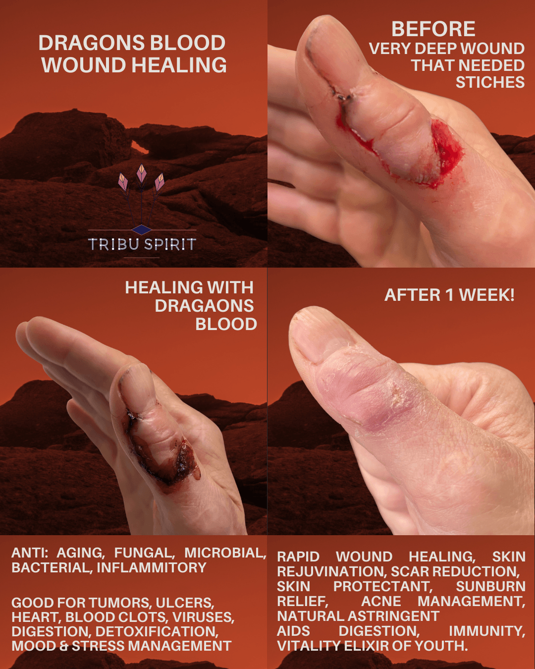 Dragons Blood